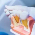 Business 1 image DENTAL IMPLANTS WEST HOUSTON Dentists in Houston TX