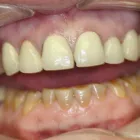 Business 3 image DONALD K. JOHNSON DMD COSMETIC AND FAMILY DENTISTRY in London KY