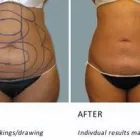 Business 1 image DR. CHICAGO LIPO Facial Plastic Surgery in Chicago IL