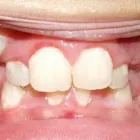 Business 5 image DR. JESUS MARTINEZ ORTHODONTICS Orthodontists in Miami FL