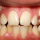 Business 7 image DR. JESUS MARTINEZ ORTHODONTICS Orthodontists in Miami FL