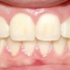 Business 8 image DR. JESUS MARTINEZ ORTHODONTICS Orthodontists in Miami FL