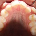 Business 3 image DR. JESUS MARTINEZ ORTHODONTICS Orthodontists in Miami FL