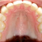 Business 4 image DR. JESUS MARTINEZ ORTHODONTICS Orthodontists in Miami FL