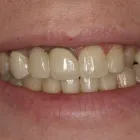 Business 2 image E.C.O. DENTAL Dentists in Orange CA