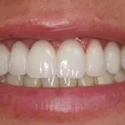 Business 3 image E.C.O. DENTAL Dentists in Orange CA