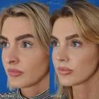 Business 3 image EDWARD S. KWAK MD - ESKMD FACIAL PLASTIC SURGERY Plastic Surgeons in New York NY