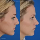 Business 4 image EDWARD S. KWAK MD - ESKMD FACIAL PLASTIC SURGERY Plastic Surgeons in New York NY
