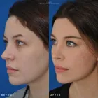 Business 6 image EDWARD S. KWAK MD - ESKMD FACIAL PLASTIC SURGERY Plastic Surgeons in New York NY