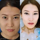 Business 10 image EDWARD S. KWAK MD - ESKMD FACIAL PLASTIC SURGERY Plastic Surgeons in New York NY