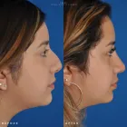Business 12 image EDWARD S. KWAK MD - ESKMD FACIAL PLASTIC SURGERY Plastic Surgeons in New York NY