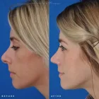 Business 14 image EDWARD S. KWAK MD - ESKMD FACIAL PLASTIC SURGERY Plastic Surgeons in New York NY