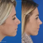 Business 16 image EDWARD S. KWAK MD - ESKMD FACIAL PLASTIC SURGERY Plastic Surgeons in New York NY