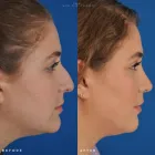 Business 17 image EDWARD S. KWAK MD - ESKMD FACIAL PLASTIC SURGERY Plastic Surgeons in New York NY
