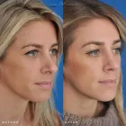 Business 18 image EDWARD S. KWAK MD - ESKMD FACIAL PLASTIC SURGERY Plastic Surgeons in New York NY
