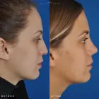 Business 22 image EDWARD S. KWAK MD - ESKMD FACIAL PLASTIC SURGERY Plastic Surgeons in New York NY