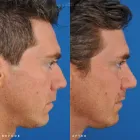 Business 24 image EDWARD S. KWAK MD - ESKMD FACIAL PLASTIC SURGERY Plastic Surgeons in New York NY