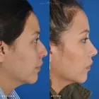 Business 27 image EDWARD S. KWAK MD - ESKMD FACIAL PLASTIC SURGERY Plastic Surgeons in New York NY