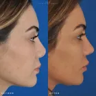 Business 28 image EDWARD S. KWAK MD - ESKMD FACIAL PLASTIC SURGERY Plastic Surgeons in New York NY