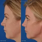 Business 29 image EDWARD S. KWAK MD - ESKMD FACIAL PLASTIC SURGERY Plastic Surgeons in New York NY