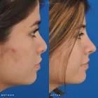 Business 30 image EDWARD S. KWAK MD - ESKMD FACIAL PLASTIC SURGERY Plastic Surgeons in New York NY