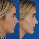 Business 38 image EDWARD S. KWAK MD - ESKMD FACIAL PLASTIC SURGERY Plastic Surgeons in New York NY