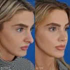 Business 39 image EDWARD S. KWAK MD - ESKMD FACIAL PLASTIC SURGERY Plastic Surgeons in New York NY