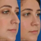 Business 46 image EDWARD S. KWAK MD - ESKMD FACIAL PLASTIC SURGERY Plastic Surgeons in New York NY