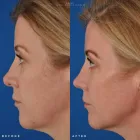 Business 48 image EDWARD S. KWAK MD - ESKMD FACIAL PLASTIC SURGERY Plastic Surgeons in New York NY