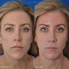 Business 49 image EDWARD S. KWAK MD - ESKMD FACIAL PLASTIC SURGERY Plastic Surgeons in New York NY