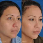 Business 54 image EDWARD S. KWAK MD - ESKMD FACIAL PLASTIC SURGERY Plastic Surgeons in New York NY