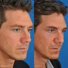 Business 56 image EDWARD S. KWAK MD - ESKMD FACIAL PLASTIC SURGERY Plastic Surgeons in New York NY