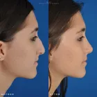 Business 61 image EDWARD S. KWAK MD - ESKMD FACIAL PLASTIC SURGERY Plastic Surgeons in New York NY