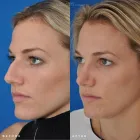 Business 64 image EDWARD S. KWAK MD - ESKMD FACIAL PLASTIC SURGERY Plastic Surgeons in New York NY