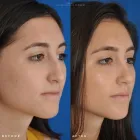 Business 65 image EDWARD S. KWAK MD - ESKMD FACIAL PLASTIC SURGERY Plastic Surgeons in New York NY