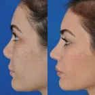Business 68 image EDWARD S. KWAK MD - ESKMD FACIAL PLASTIC SURGERY Plastic Surgeons in New York NY