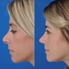 Business 71 image EDWARD S. KWAK MD - ESKMD FACIAL PLASTIC SURGERY Plastic Surgeons in New York NY