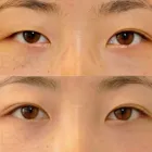 Business 75 image EDWARD S. KWAK MD - ESKMD FACIAL PLASTIC SURGERY Plastic Surgeons in New York NY