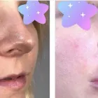 Business 2 image EFFECTIVE NONSURGICAL FACELIFT HIFU - AGELESS MD Medical Spas in Tustin CA