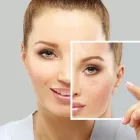 Business 4 image EFFECTIVE NONSURGICAL FACELIFT HIFU - AGELESS MD Medical Spas in Tustin CA