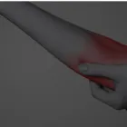 Business 3 image ELBOW PAIN Chiropractors in Staten Island NY