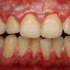 Business 2 image EMERGENCY DENTAL SERVICE JACKSONVILLE, FL 32218 Dentists in Jacksonville FL