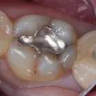 Business 6 image EMERGENCY DENTAL SERVICE MIAMI, FL 33162 Dentists in Miami FL