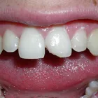 Business 3 image EMERGENCY DENTAL SERVICE MIAMI, FL 33162 Dentists in Miami FL