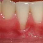 Business 6 image EMERGENCY DENTAL SERVICE SAN ANTONIO, TX 78229 in San Antonio TX