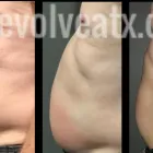 Business 6 image EVOLVE CRYO + WELLNESS in Austin TX