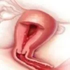 Business 1 image FIBROIDS TREATMENT AND REMOVAL in Brooklyn NY