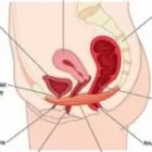 Business 3 image FIBROIDS TREATMENT AND REMOVAL in Brooklyn NY