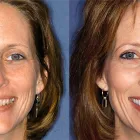 Business 3 image GREGORY LUTKE DDS Geriatric Care in Plano TX
