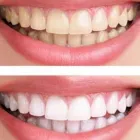 Business 2 image HEALTHY SMILE DENTAL CARE TMJ Treatment in Oakland CA